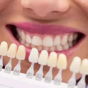 Implante dental zirconia