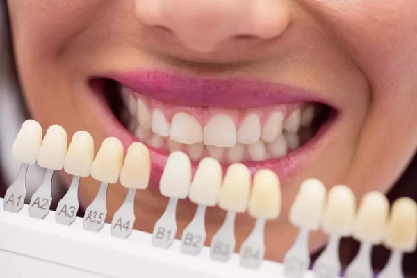 Implante dental zirconia